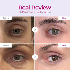 Dr.Melaxin Calcium IntenseFirming Cream with Collagen &Elastin, Lifting & VolumizingFace Cream for Sagging Skin,Niacinamide for Plumping Care